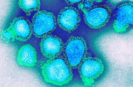 Dois moradores de Bituruna morrem por infecção da gripe H3N2, diz SESA